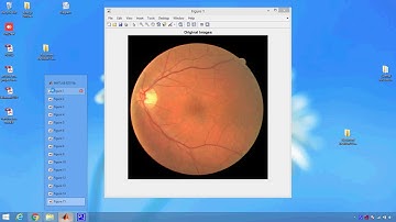 Recurrent Residual Convolutional Neural Network based on U Net R2U Net for Medical Image Segmentatio