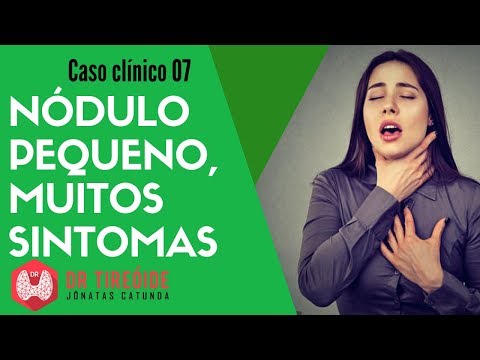 Vídeo: Nódulo Na Garganta: Causas, Tratamento E Muito Mais