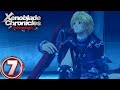 Xong phần chân, nghỉ ngơi tại phần lưng!! - Xenoblade Chronicles DE #7