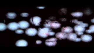Hurting by Ben Sollee