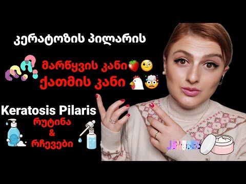 ქათმის კანი - კერატოზის პილარის - რუტინა და რჩევები | Nina Todria