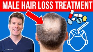Doctor explains Male Hair Loss Treatment
