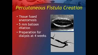 U.s. Ellipsys Registry