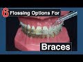 How to Floss with Braces