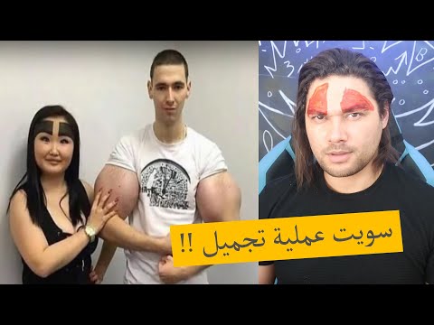عمليات تجميل البنات !! فيديو مضحك 😂😂