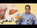 الكبد الدهنى الكبد الدهنى
