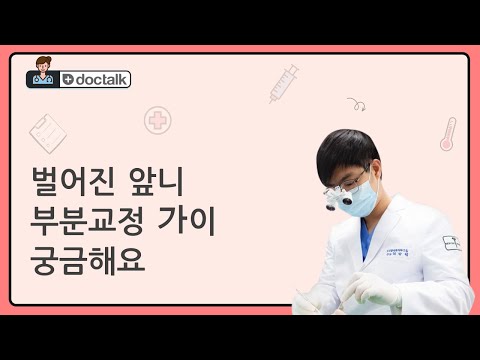 벌어진 앞니 부분교정 가이 궁금해요 (부산 20대 중반/남 벌어진앞니부분교정)