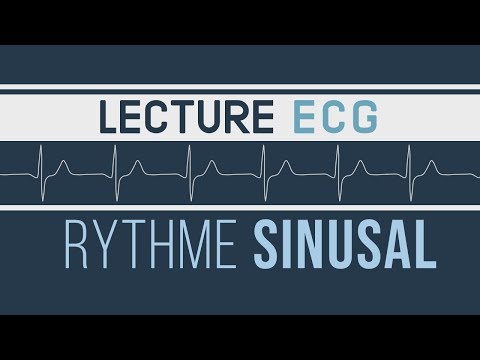 Interprétation ECG - Rythme Sinusal