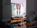 femoral nerve glide exercise जाँघ के आगे वाला भाग quadriceps muscle
