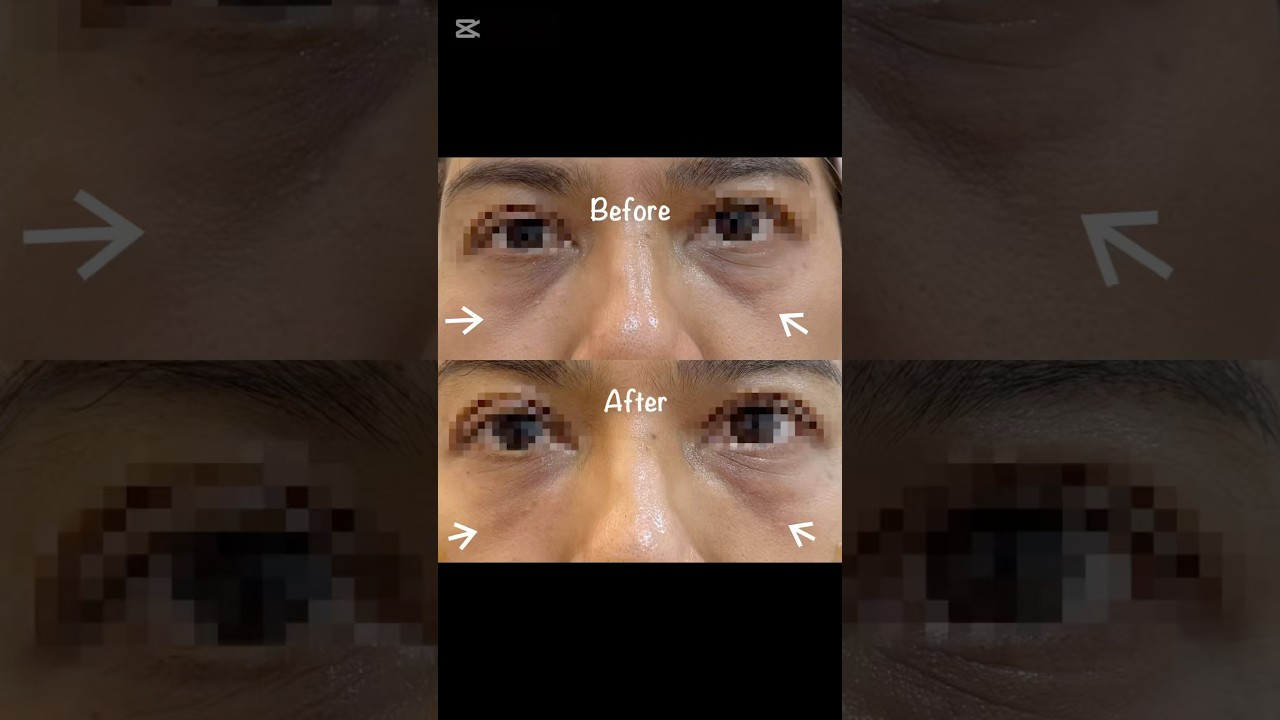 For youthful eyes 👀😍 