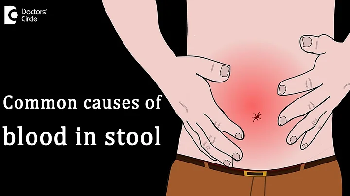 Most common causes of blood in stool - Dr. Rajasekhar M R - DayDayNews