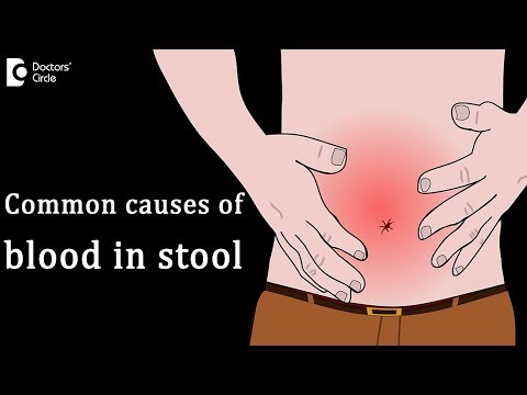 Most common causes of blood in stool - Dr. Rajasekhar M R