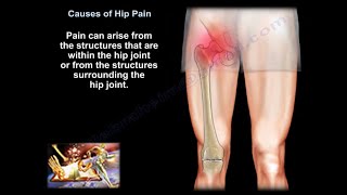 hip pain, causes, diagnosis  and treatment.
