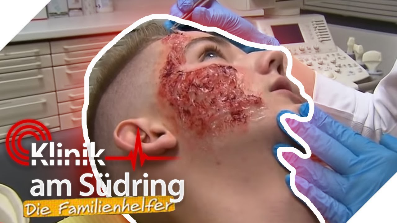 Halbes Gesicht verbrannt! Wieso kann Ärztin die Haut einfach abziehen? | Die Familienhelfer | SAT.1