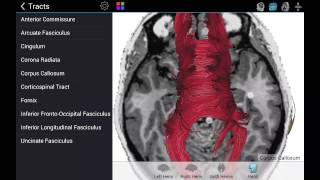 Brain Tutor Demo screenshot 1