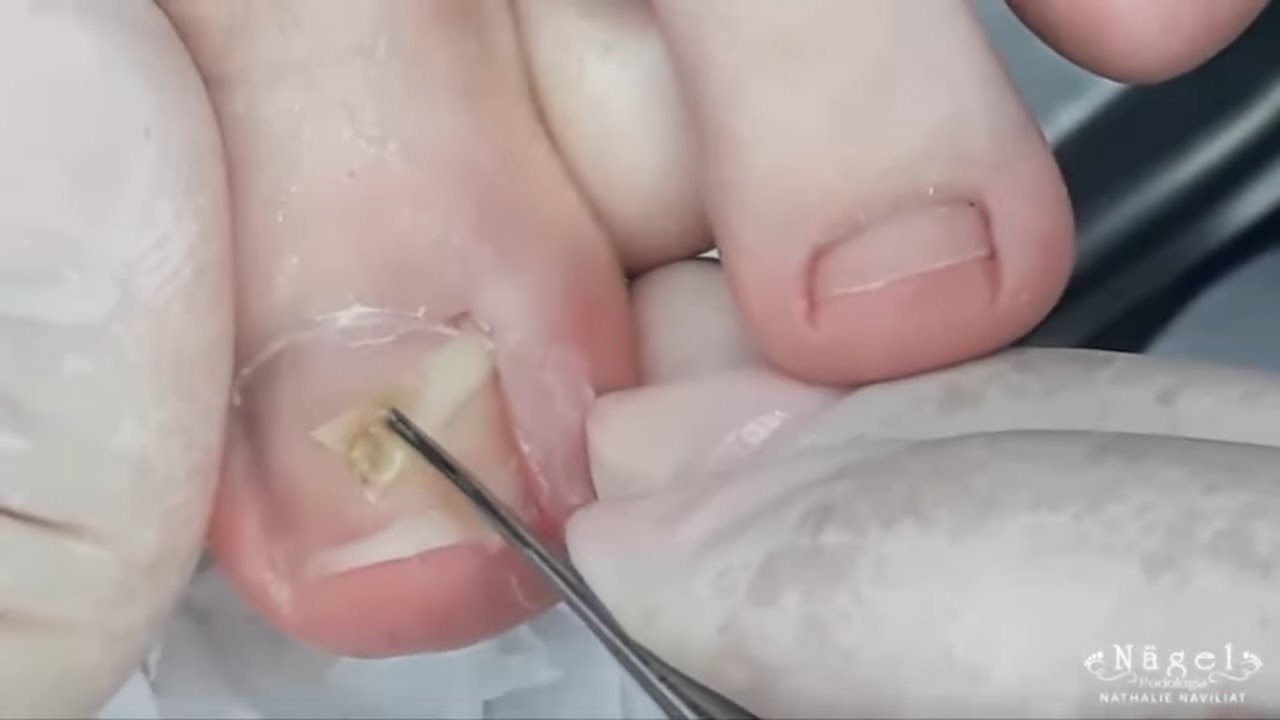 Она даже ходить не могла из-за боли... Кажется, что там даже не всё осталось.