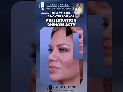 Video thumbnail: 3 Months Post-Op Transformation! #PreservationRhinoplasty #Rhinoplasty #SanAntonioSurgeon