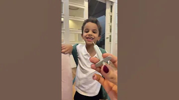 عبودي ياخذ ابرة وهو يضحك 