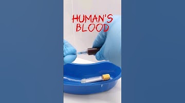 after blood extraction #laboratory #mls #cls #medtechstudent #phlebotomy #blood #bloodcollection