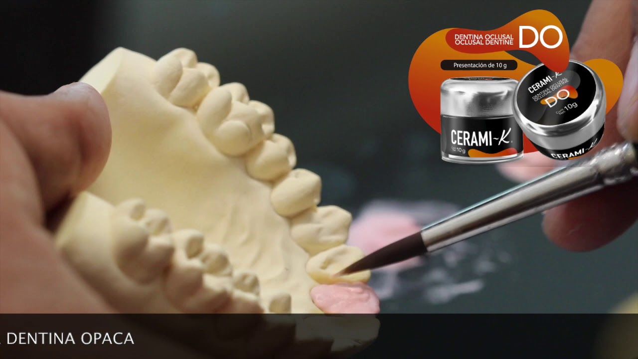 Cerámicas Dentales CERAMIK® YouTube