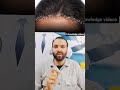 watch till end #audio