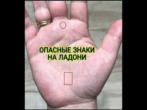 Знаки смерти на ладони фото примеры