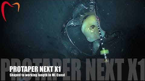 Easy and fast technique for Shaping Canals with Protaper NEXT Rotary Files