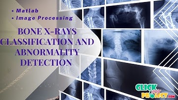 Matlab Image Processing Projects - Bone X-Rays Classification & Detection - ClickMyProject