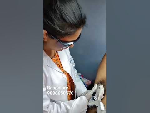 how to care underarm Tan Removal - underarm Tan Removal -#tanremoval #
