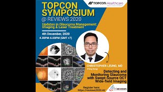 Christopher Leung, MD - Detecting and Monitoring Glaucoma with Swept-Source OCT Wide-field Imaging Primary Open Angle Glaucoma Dr Christopher Leung