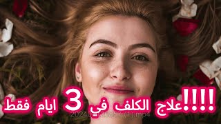 وصفة طبيعية لعلاج الكلف والتصبغات الجلدية في 3 ايام فقط ?‍♀️| ازالة الكلف بعد الولادة بسهولة .