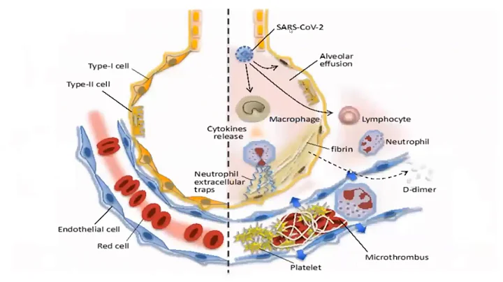 Venous Thromboembolism: Evidence pre-COVID and current COVID observations