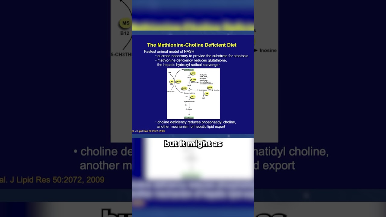 Robert Lustig, MD: Why Methionine and Choline Deficiency Can Trigger Fatty Liver Without Obesity