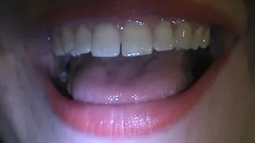 Uvula while singing
