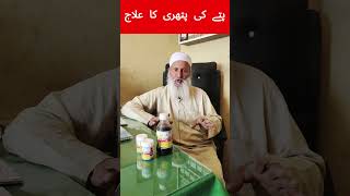 pitte ki pathri ka ilaj Gallbladder ston treatment