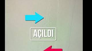 Bacak Damar Tıkanıklığı, Diyabetik Ayak, Anjiyo Ile Tedavi