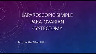 Laparoscopic Simple Para Ovarian Cystectomy  د لؤي أبوعتيله - استئصال كيس جار مبيضي بالمنظار الجراحي