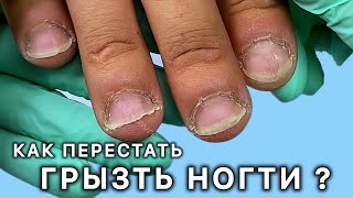 картинка: ГРЫЗЕТ и ковыряет ногти