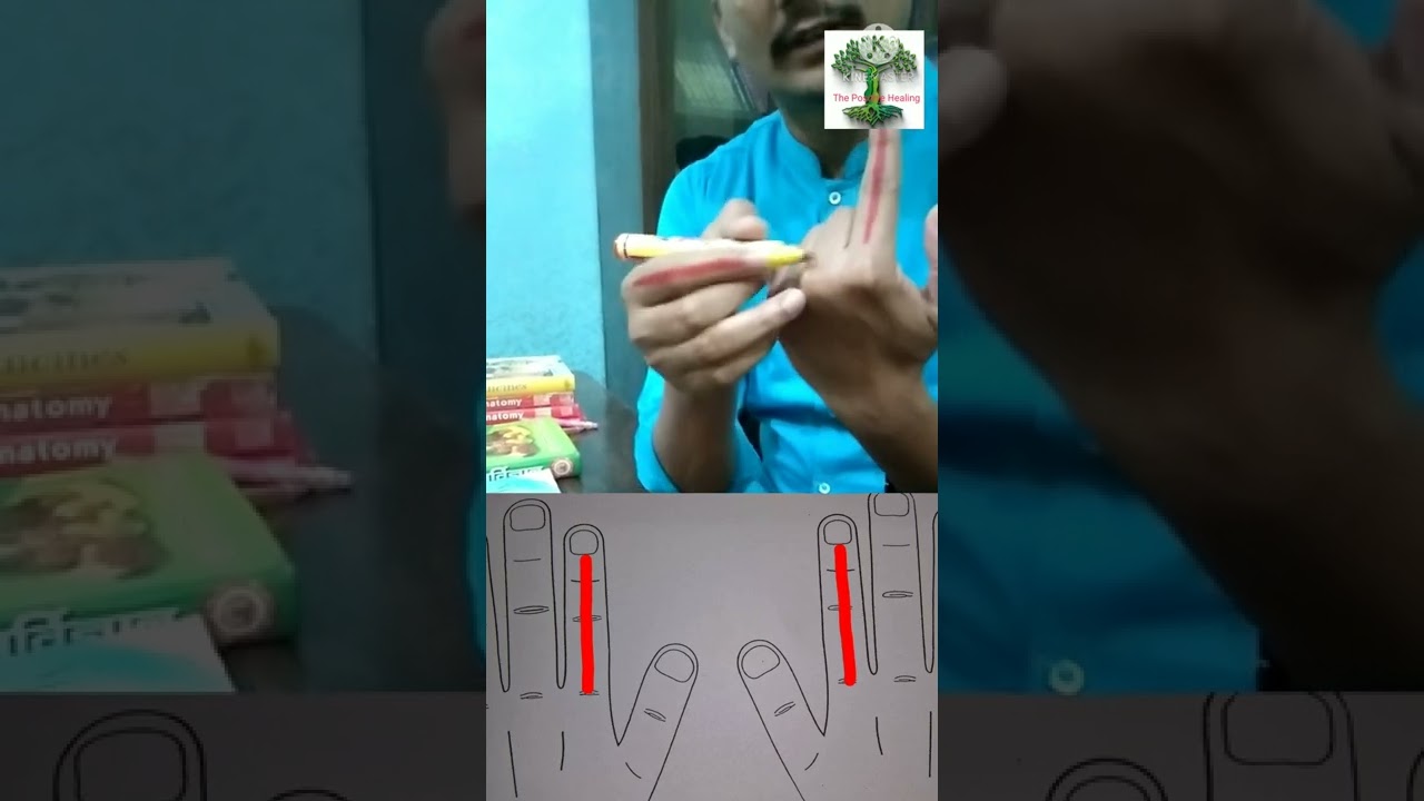 Extreme Cold feeling (अत्यधिक ठंड लगना) treat by Colour therapy.