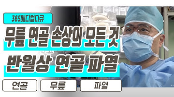 무릎 연골 손상의 모든 것 반월상 연골 파열 / 무릎 관절 어떻게 관리해야할까? / 연골 관리 치료방법 / 365 메디컬다큐 부산MBC 20201130 방송