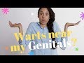 Warts near my Genitals? ★Help★ hpv