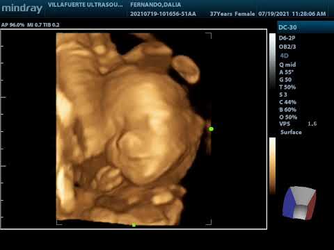 Baby Gav 3D Video