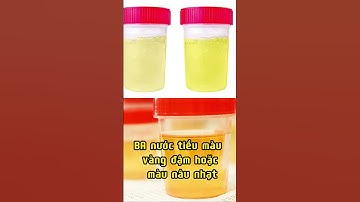 Màu Nước  Tiểu Cảnh Báo Điều Gì Tới Sức Khỏe Của Bạn? #nakifa#suckhoe