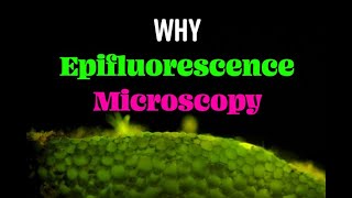The Power of Epifluorescence Microscopy
