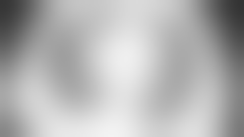 Uniportal VATS middle lobectomy