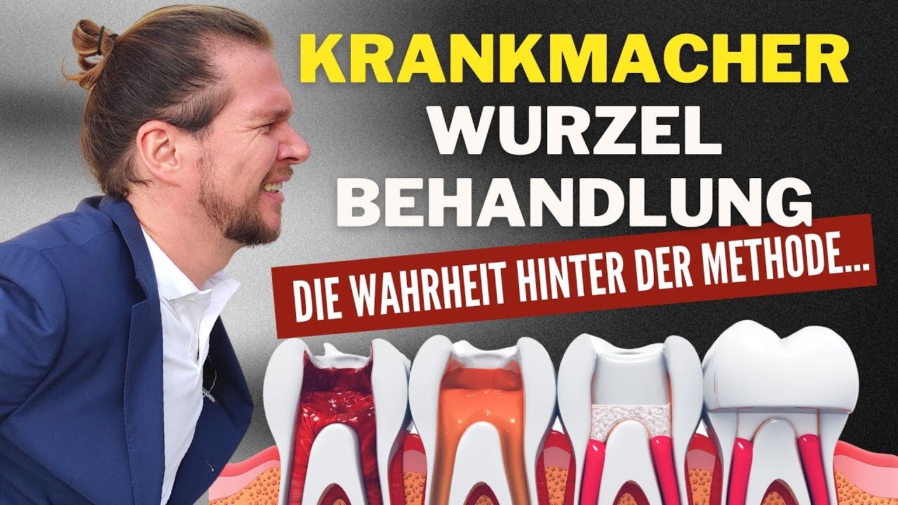 WURZELBEHANDLUNG // Das macht ein wurzelbehandelter Zahn mit Dir ⚡ YouTube WURZELBEHANDLUNG // Das macht ein wurzelbehandelter Zahn mit Dir ⚡ YouTube