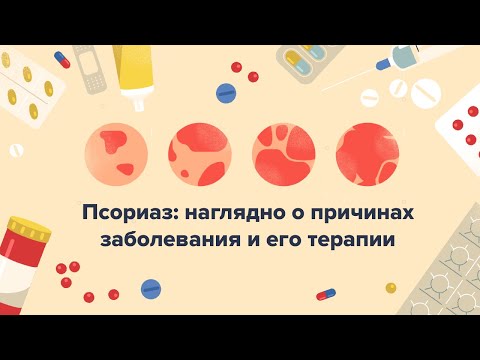 Все о псориазе: лечение, виды, профилактика