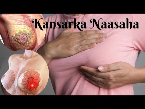 OGOW: SABABTA IYO CALAAMADAHA LAGU GARTO KANSARKA (Cancer) NAASAHA