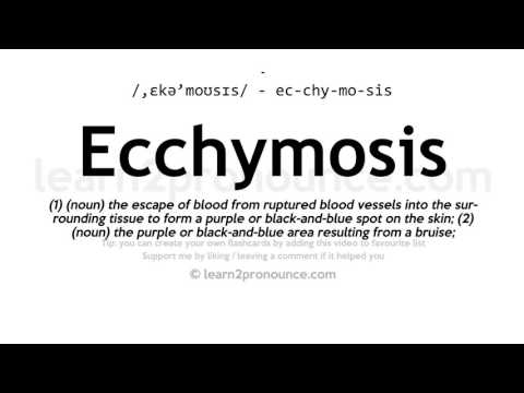 Произношение экхимоз | Определение Ecchymosis