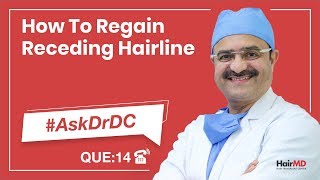 How To Regain Receding Hairline | #AskDrDc Ep 14 | HairMD, Pune | (In HINDI)